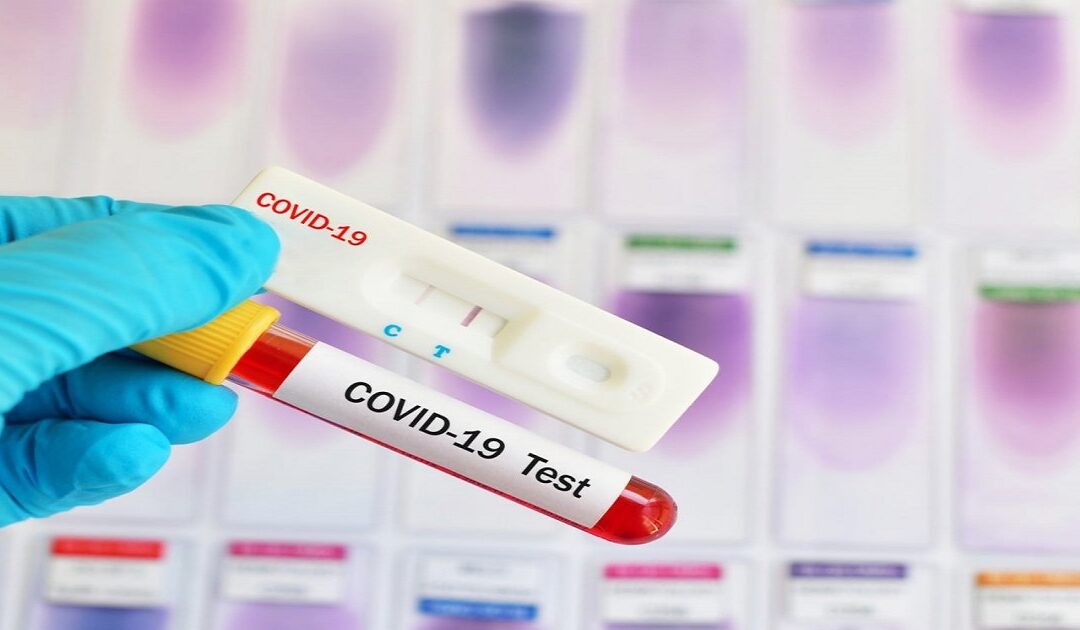 Δελτίο Τύπου Ο.Κ.Π.Α.Π.Α.: “Διενέργεια rapid test στην δομή Ξενώνας Φιλοξενίας Γυναικών Θυμάτων Βίας και των Παιδιών τους”